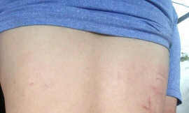 Người đàn ông bị hành hung sau khi trả lời phóng sự điều tra VTV9 