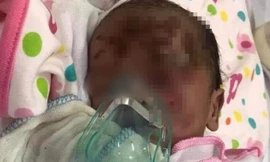 Bé trai sơ sinh bị bỏ rơi tại Yên Bái.