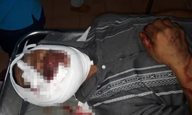 Ông Chìu bị thương nặng sau cuộc hỗn chiến