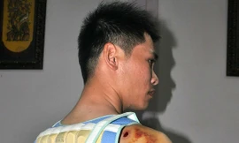 Anh Mậu bị con trai bí thư xã Nhân Cơ đánh