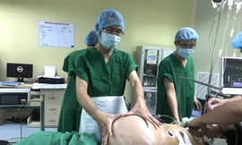 Khối u khổng lồ của bệnh nhân Đặng Thị Mỹ Lệ