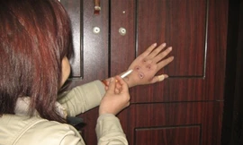 Những kiểu 'hành xác' lạnh người của giới trẻ