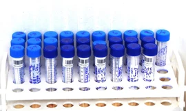 Bệnh nhân được xét nghiệm lần đầu cho kết quả âm tính.