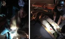 Cán bộ CSGT và dân phòng bị tông gãy chân.