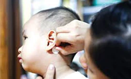 Nguy hiểm khi dùng miếng dán chống say xe cho trẻ.