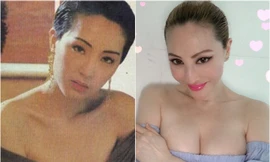 Nữ diễn viên “Thiện nữ u hồn” mặt biến dạng vì mê phẫu thuật thẩm mỹ