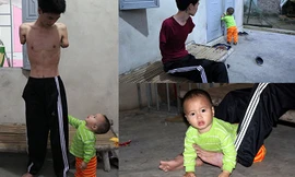 Cám cảnh cha mất hai tay chăm con thơ 14 tháng tuổi