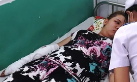 Vết thương trên cánh tay chị Yến dài 20 cm. Ảnh: Hải Hiếu