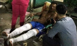 Anh Phi vào giúp chị Trang lấy giấy tờ cũng bị bỏng nặng ở hai chân. Ảnh: Hải Hiếu