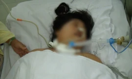 Một trường hợp mắc não mô cầu nguy kịch