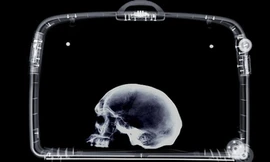 Máy quét an ninh phát hiện có hộp sọ người trong hành lý của ông giáo sư. Ảnh: Stuff