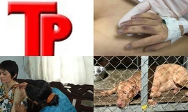 Bản tin Hình sự: Tin mới vụ cụ bà bị chó dữ cắn chết