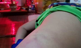 Phụ huynh tố giáo viên chủ nhiệm đánh con mình bầm tím cơ thể. Ảnh: Người nhà đăng tải