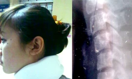 Chủ tịch CLB BĐS Hà Nội bị tố đánh con trật xương cổ