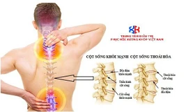 TT điều trị phục hồi xương khớp Việt Nam – Địa chỉ điều trị thoái hóa cột sống hiệu quả 