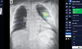 Vinbrain giành giải thưởng quốc tế ‘Công nghiệp ACM Sigai 2021'