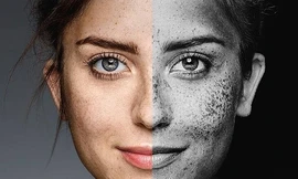 Bụi mịn PM2.5 - kẻ phá hoại collagen kích hoạt lão hoá thầm lặng