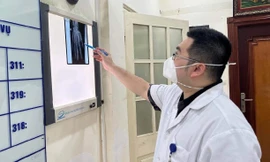 Phim Xquang bàn tay chấn thương nặng do điện thoại phát nổ khi sạc của thanh niên ở Hà Nội. Ảnh: BV cung cấp