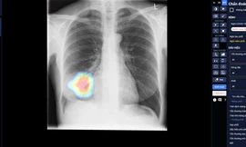 DrAid – Công cụ sàng lọc và tiên lượng điều trị COVID-19 ứng dụng AI đầu tiên tại Việt Nam