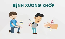 Việt Nam chiết xuất thành công hoạt chất mới tốt cho bệnh khớp