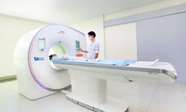 Siêu máy chụp CT phát hiện sớm đột quỵ, ung thư tạng