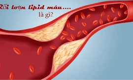 Lipidcleanz - Công thức thảo dược cho người rối loạn lipid máu!