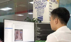 VinBrain sử dụng 'siêu máy tính' cho các giải pháp ứng dụng AI 