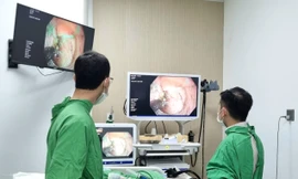 Bác sĩ trẻ tiên phong đưa kỹ thuật can thiệp ung thư sớm đường tiêu hóa qua nội soi về Tây Nguyên 