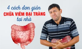 4 loại 'cây nhà lá vườn' giúp cải thiện triệu chứng viêm đại tràng