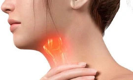 Tiêu Khiết Thanh - Giải pháp 'vàng' cho người bị viêm thanh quản