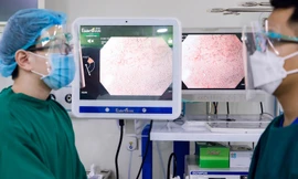 Nhẹ mối lo ung thư nhờ công nghệ nội soi tiêu hóa hiện đại