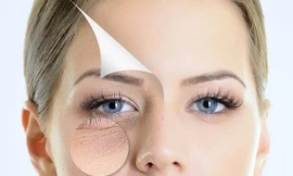 Lão hóa ngược nhờ vào hoạt chất Ectoine trong bộ kem dưỡng cao cấp Ovy Luxury Face