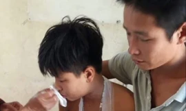 Máy tính xách tay phát nổ, 3 học sinh bị thương nặng