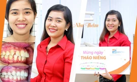 Niềng răng đẹp cỡ nào - câu chuyện niềng răng nhiều cảm xúc của cô giáo Như Thắm