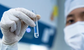 SIAM Thailand đầu tư vào công nghệ tế bào gốc, công bố giấy phép Ngân hàng mô Vicells