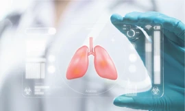 Fucoidan và tác động kép trong hỗ trợ điều trị ung thư gan và dạ dày