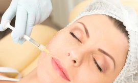 Chất tiết tế bào gốc Exosome tại Việt Nam có được cấp phép tiêm hay không?