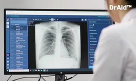 VinBrain lọt vòng chung kết cuộc thi toàn cầu “Thử thách ứng phó với đại dịch”