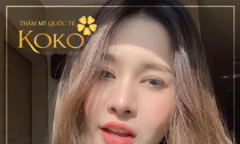 5 điều cần biết trước khi quyết định cắt mí