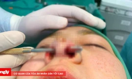 Phẫu thuật thẩm mỹ theo trào lưu: Chứng tỏ đẳng cấp hay tiền mất tật mang?