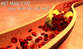 Máu nhiễm mỡ có nguy hiểm không? Cách dọn sạch mỡ máu của người Nhật