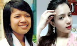 Cơ hội làm đẹp miễn phí 100% tại bệnh viện thẩm mỹ JW 