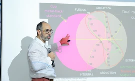 Hoàn Mỹ hợp tác cùng chuyên gia nước ngoài nâng cao năng lực điều trị các ca khó về thay khớp háng, khớp gối