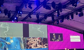 500 bác sĩ tại Pháp xem trực tiếp can thiệp mạch máu não ở Việt Nam