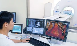 Vận hành “siêu máy chụp CT” kịp thời phục vụ người dân “siêu đô thị” TP.HCM thời đại vươn mình