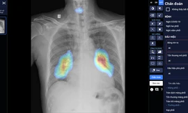 Trí tuệ nhân tạo – “trợ lý” đắc lực trong nỗ lực xây dựng Y tế số