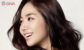 Phẫu thuật thẩm mỹ nên theo tiêu chí hài hòa, tự nhiên hay xu hướng?