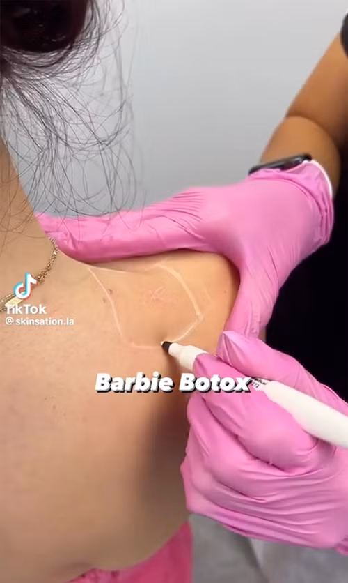 Thẩm mỹ bằng phương pháp Barbie Botox có thể gây hại cho sức khoẻ. Ảnh: TikTok.