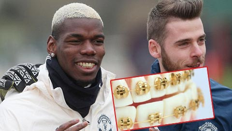 Ngôi sao M.U khoe niềng răng bằng vàng