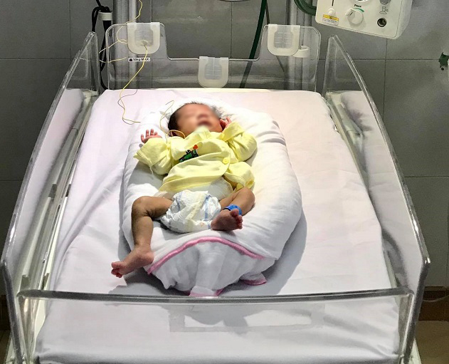 Cứu sống bé sinh non 28 tuần tuổi bị hoại tử dạ dày hiếm gặp